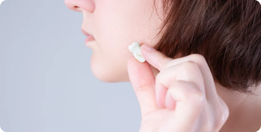 Extraction dents de sagesse