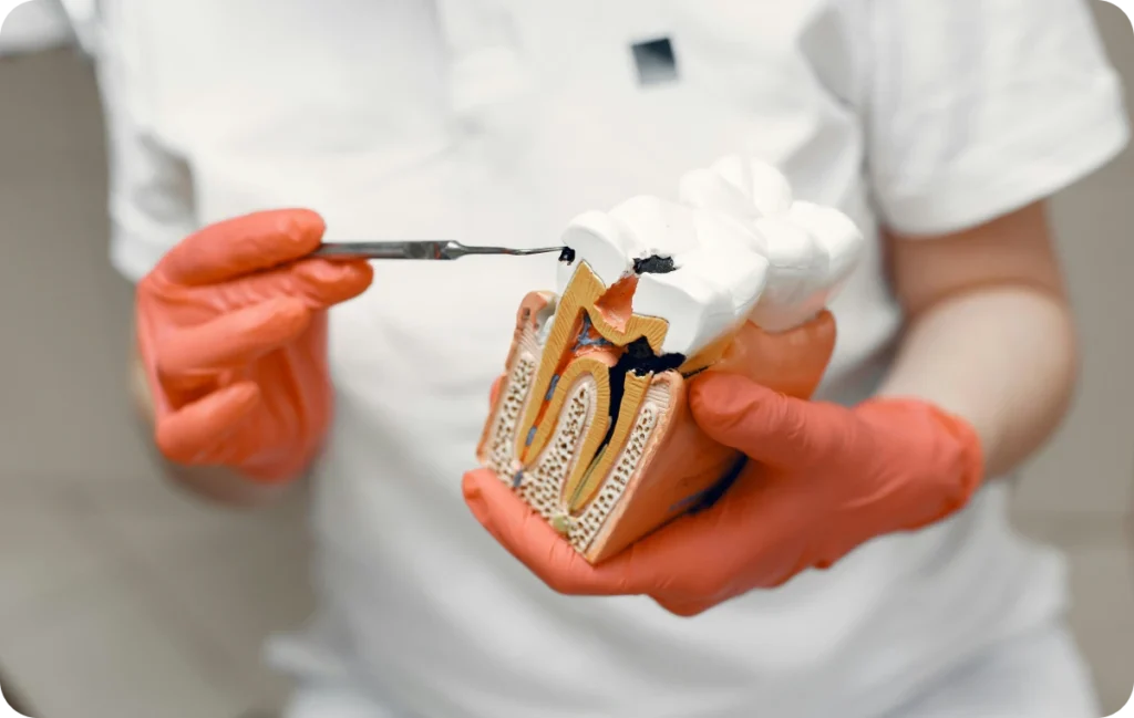 Degagement des dents incluses